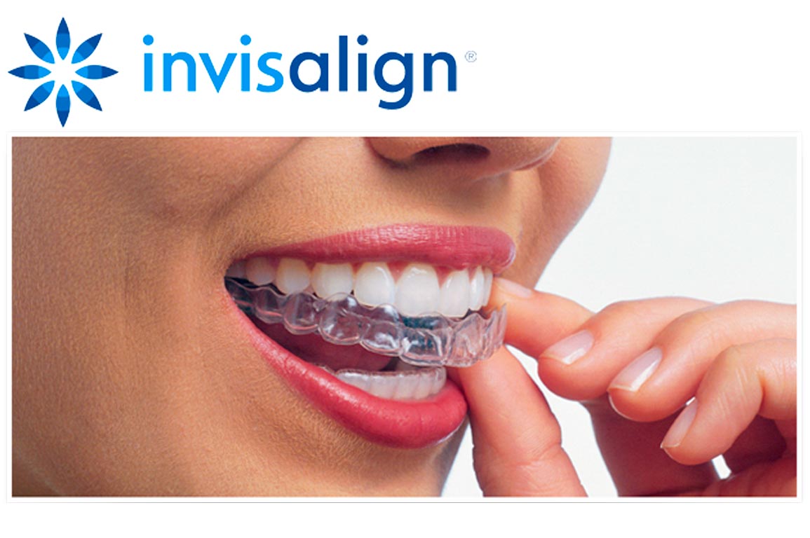 invisalign